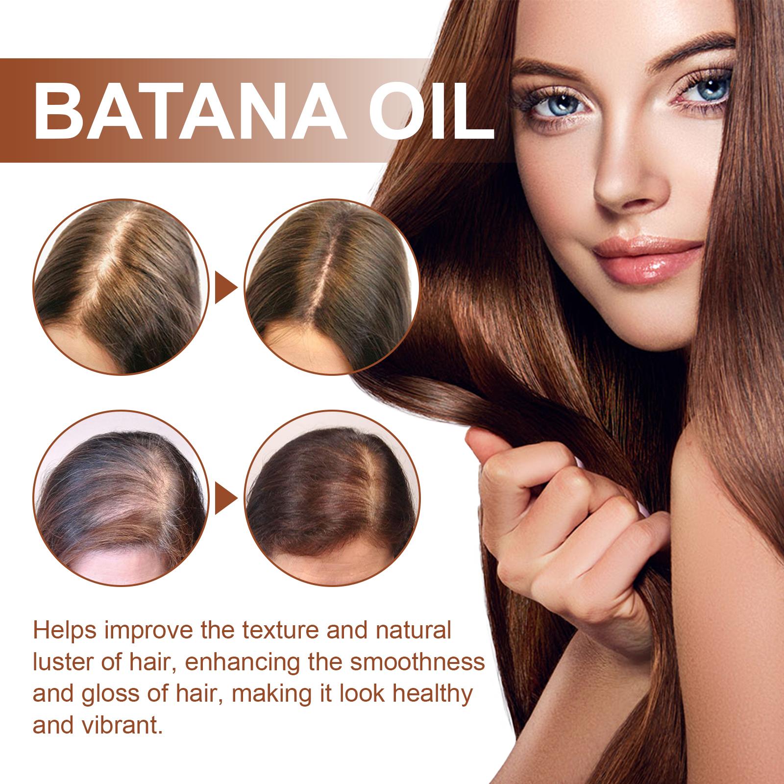Batana Oil From Honduras - Get Fuller, Thicker, Healthier Hair - Great Gifts For Women Men Conditioner Haircare Silky - Hair Nutrition - Ms.Rubies Beauty Shop