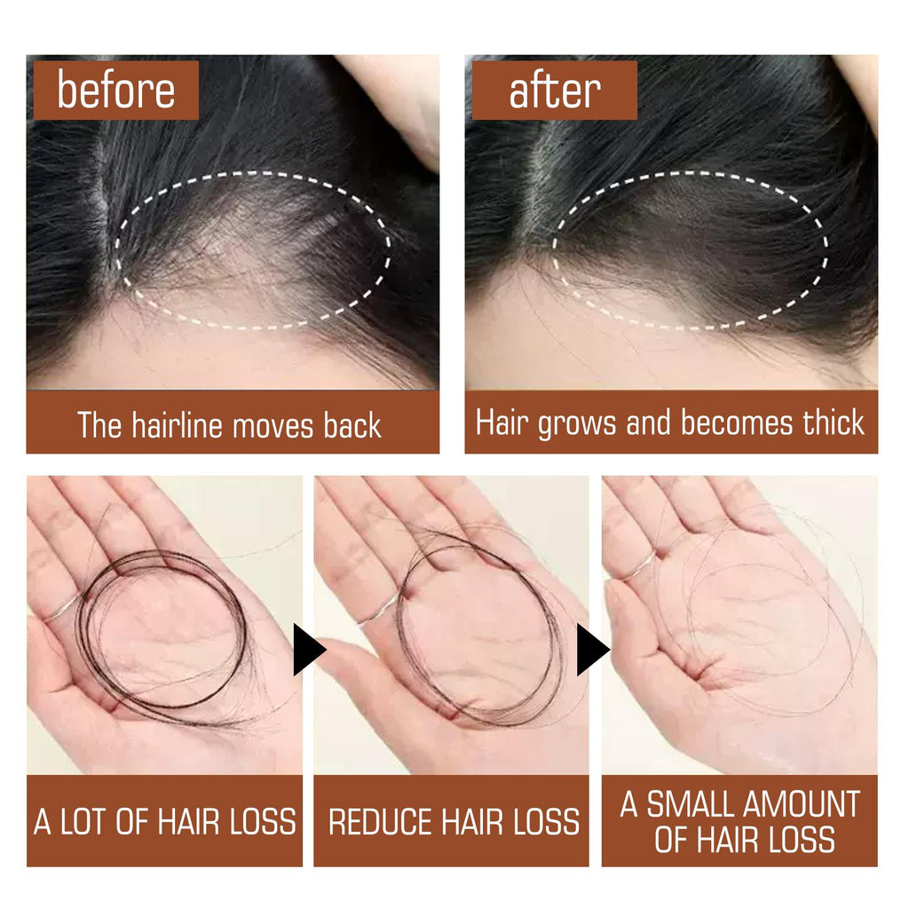 Batana Oil From Honduras - Get Fuller, Thicker, Healthier Hair - Great Gifts For Women Men Conditioner Haircare Silky - Hair Nutrition - Ms.Rubies Beauty Shop