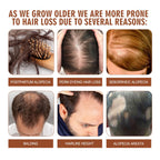 Batana Oil From Honduras - Get Fuller, Thicker, Healthier Hair - Great Gifts For Women Men Conditioner Haircare Silky - Hair Nutrition - Ms.Rubies Beauty Shop